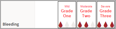 Bleeding bubble chart showing in red the grade levels one, two, and three.